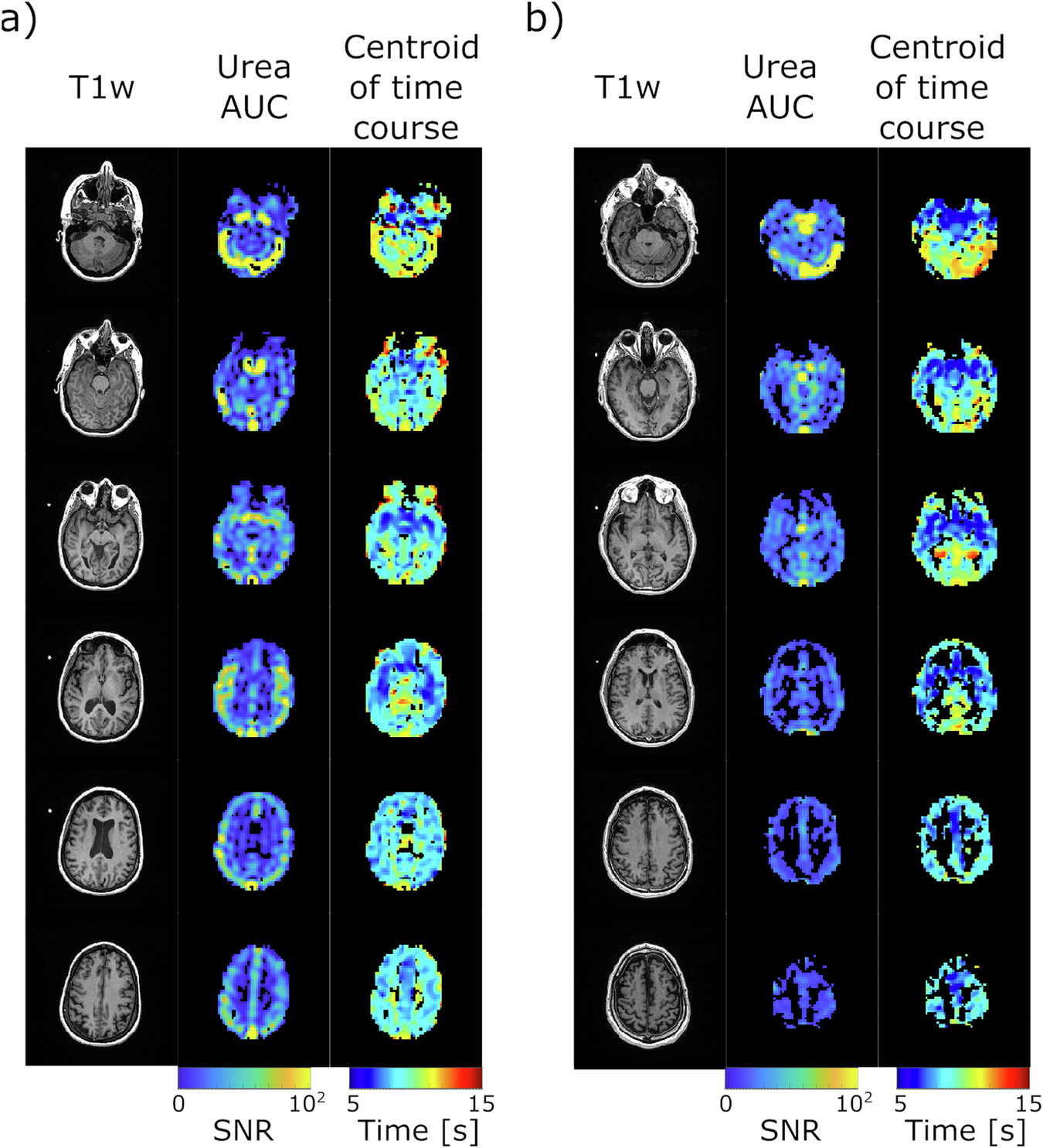 Fig. 4: Hyperpolarized [13C,15N2]urea area-under-curve (AUC) and time-course centroid maps from two subjects.