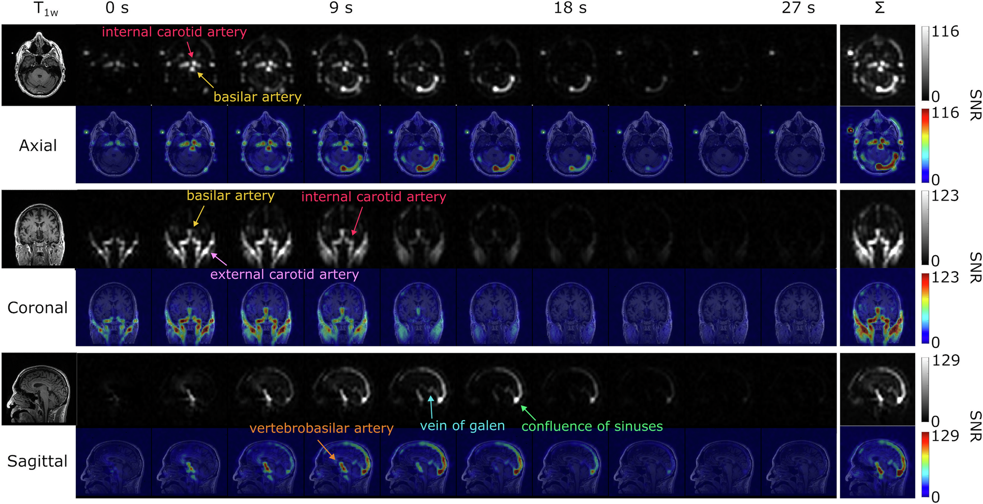 Fig. 5: Dynamic hyperpolarized [13C,15N2]urea images in multiple planes.