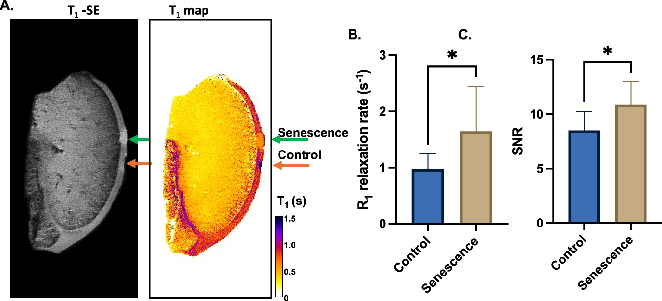 Fig. 3: Senescent cells in porcine explants detected by β-gal responsive Gd-chelate.