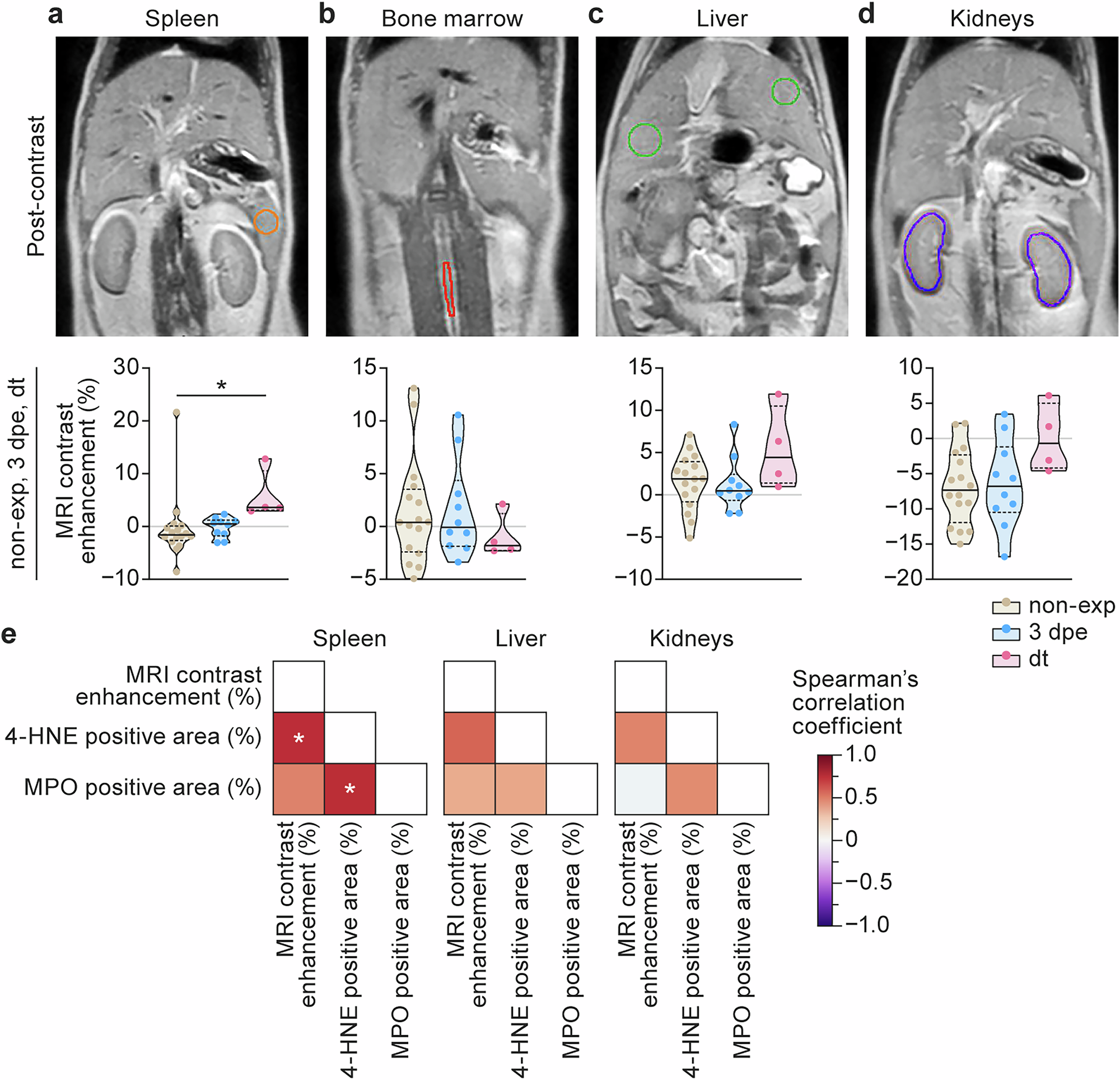 Fig. 4: In vivo magnetic resonance imaging with Fe-PyC3A corroborates reactive oxygen species-related oxidative tissue changes identified by immunohistochemistry.