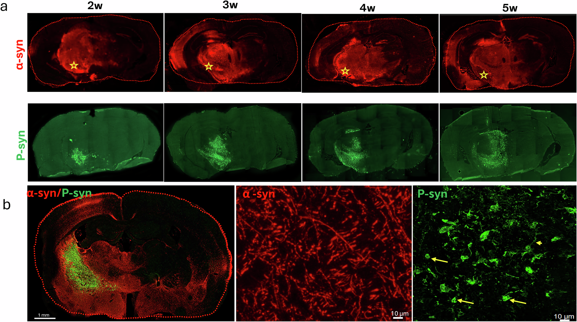 Fig. 1: Human α-syn and p-syn expression in mouse brains from 2 to 5 weeks post-injection.
