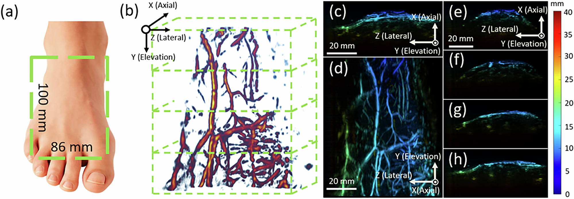 Fig. 8: PA imaging and 3D vascular reconstruction.