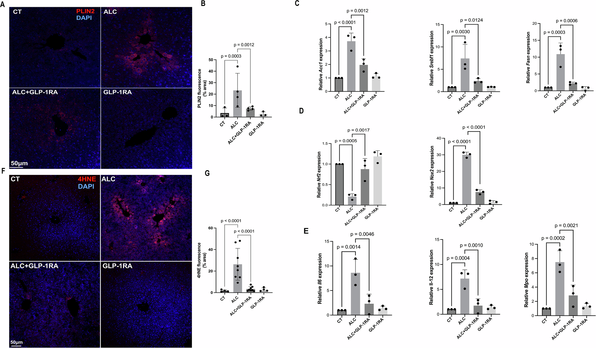 GLP-1受容体作動薬がアルコール摂取時の肝臓を保護(GLP-1 receptor agonists protect the liver during alcohol consumption)