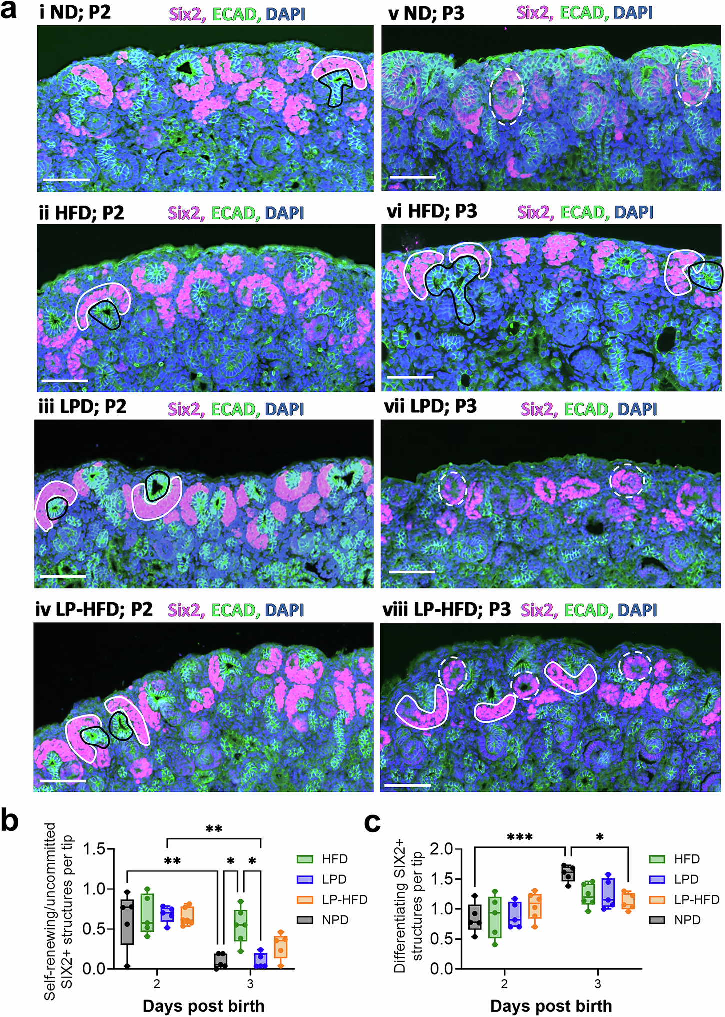Fig. 5: Prolonged nephron induction contributes to augmented nephron endowment.