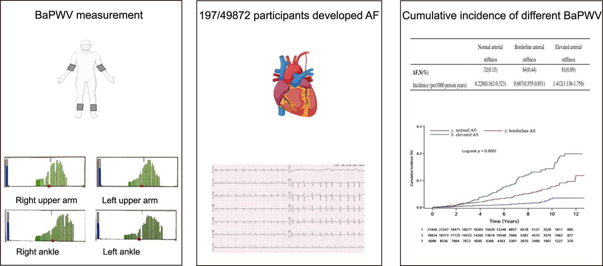Fig. 1: Brachial-ankle pulse wave velocity and the risk of new-onset atrial fibrillation.