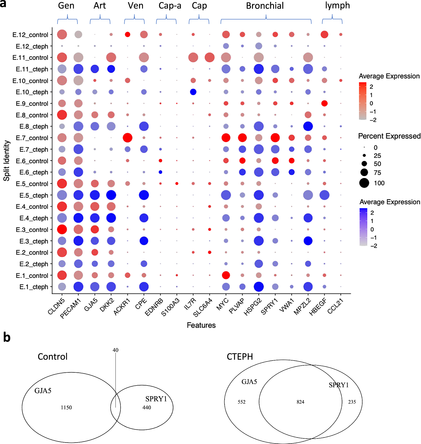 Fig. 4: Individual ECs in CTEPH PEA specimens express both pulmonary artery (PA) and bronchial artery EC markers.
