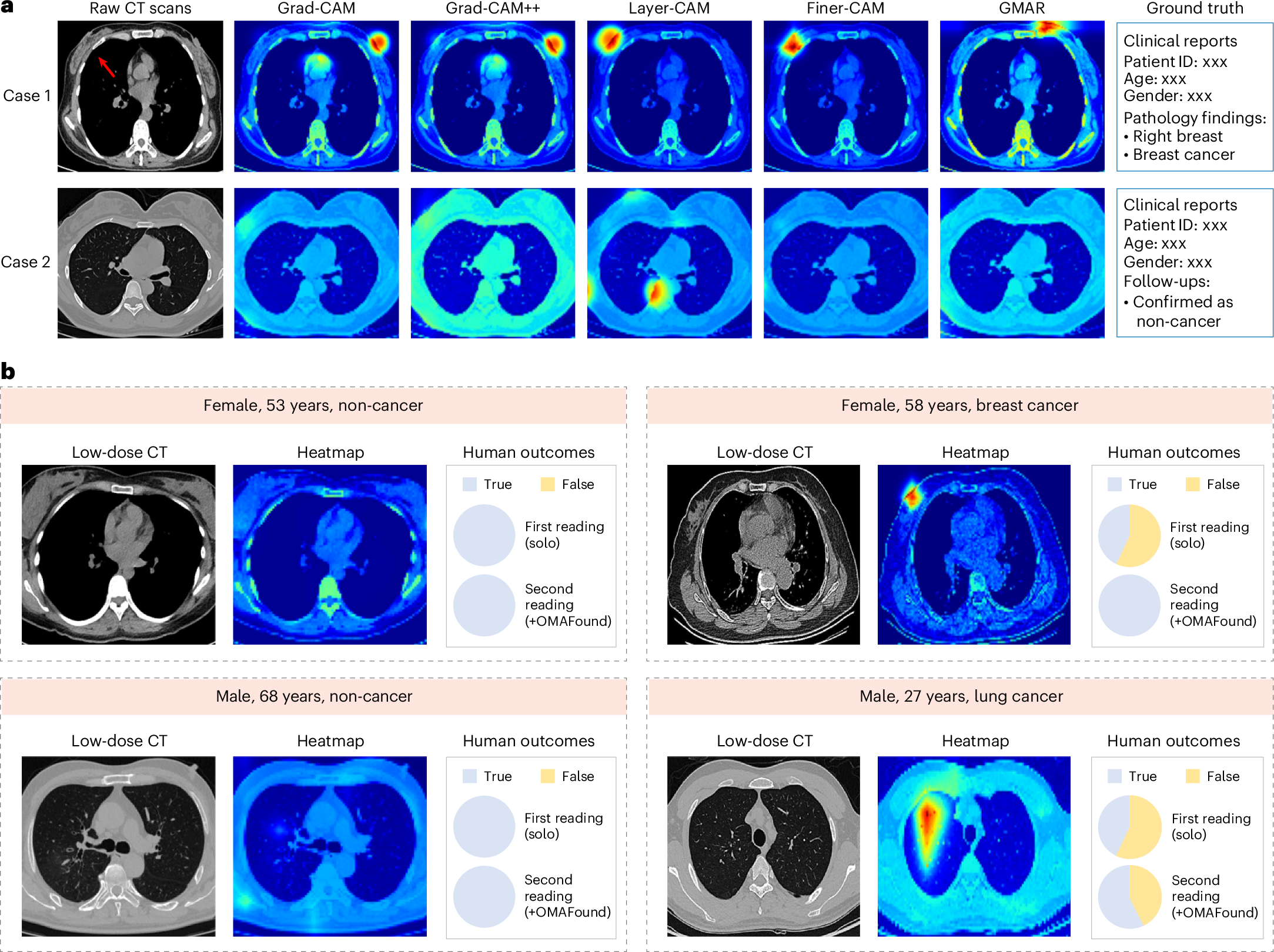 Fig. 5: The interpretability of OMAFound.