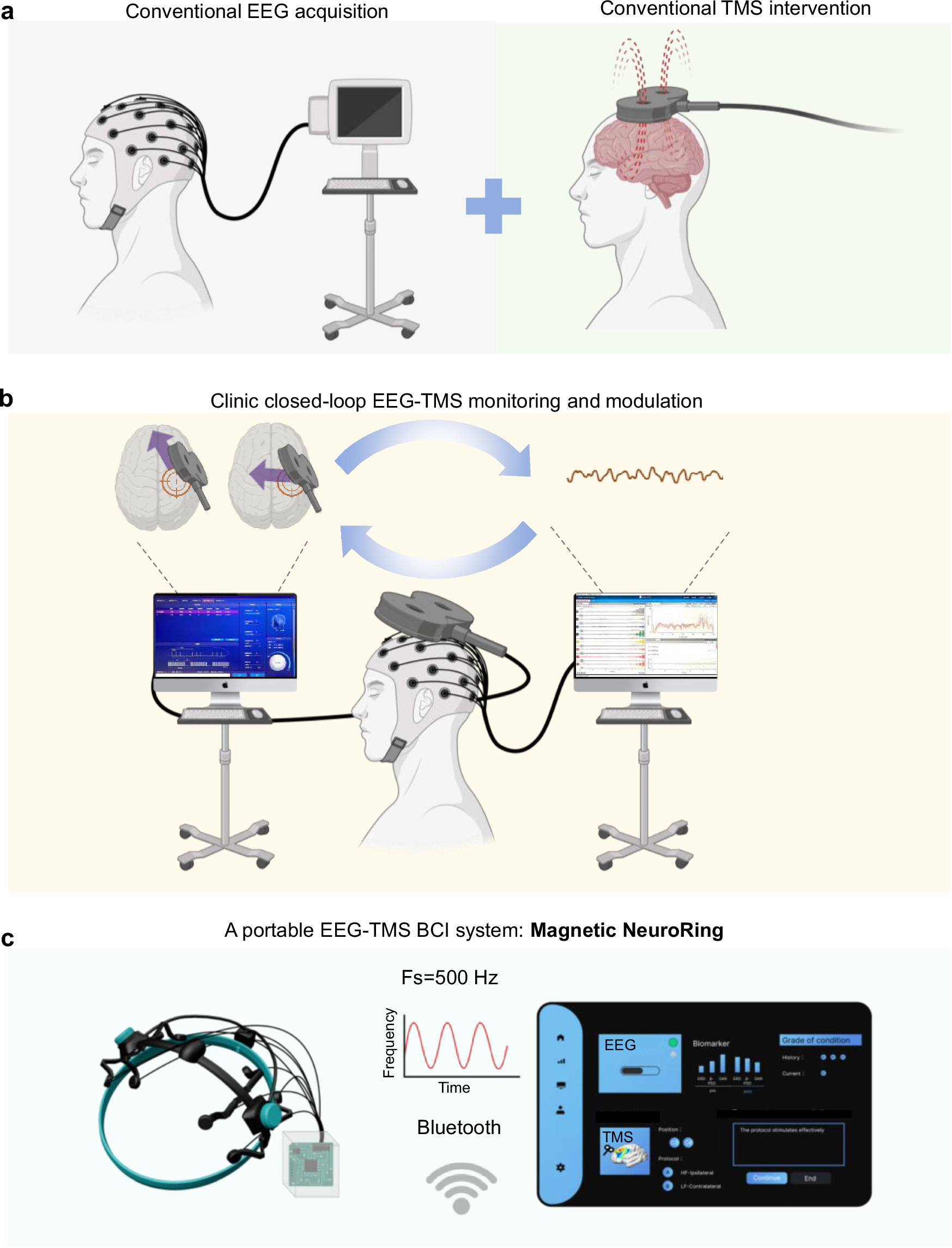 Fig. 1: Adaptive EEG-TMS integration for enhanced motor recovery assessment.