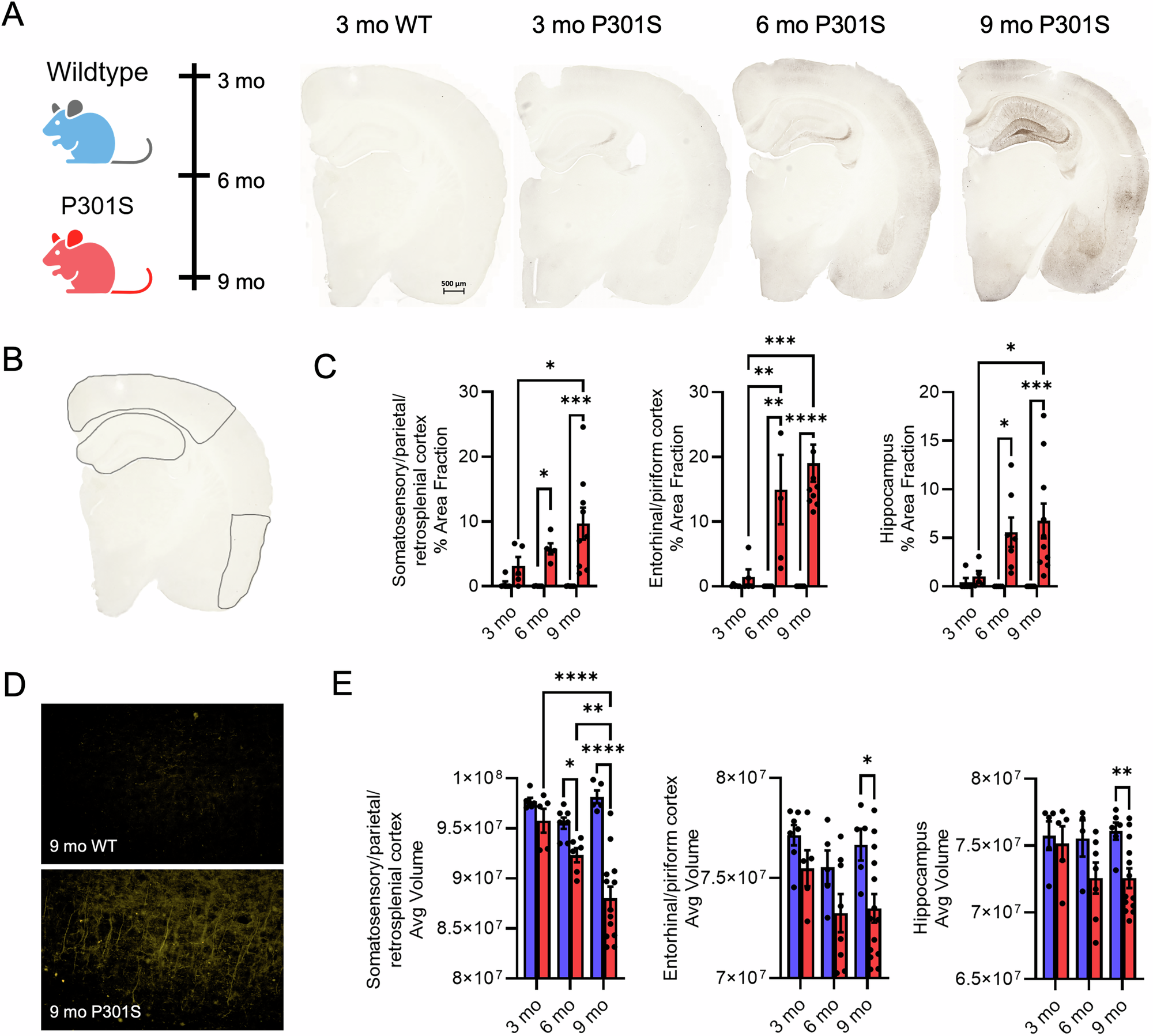 Fig. 1: Tau pathology decreases cortical and hippocampal volume.