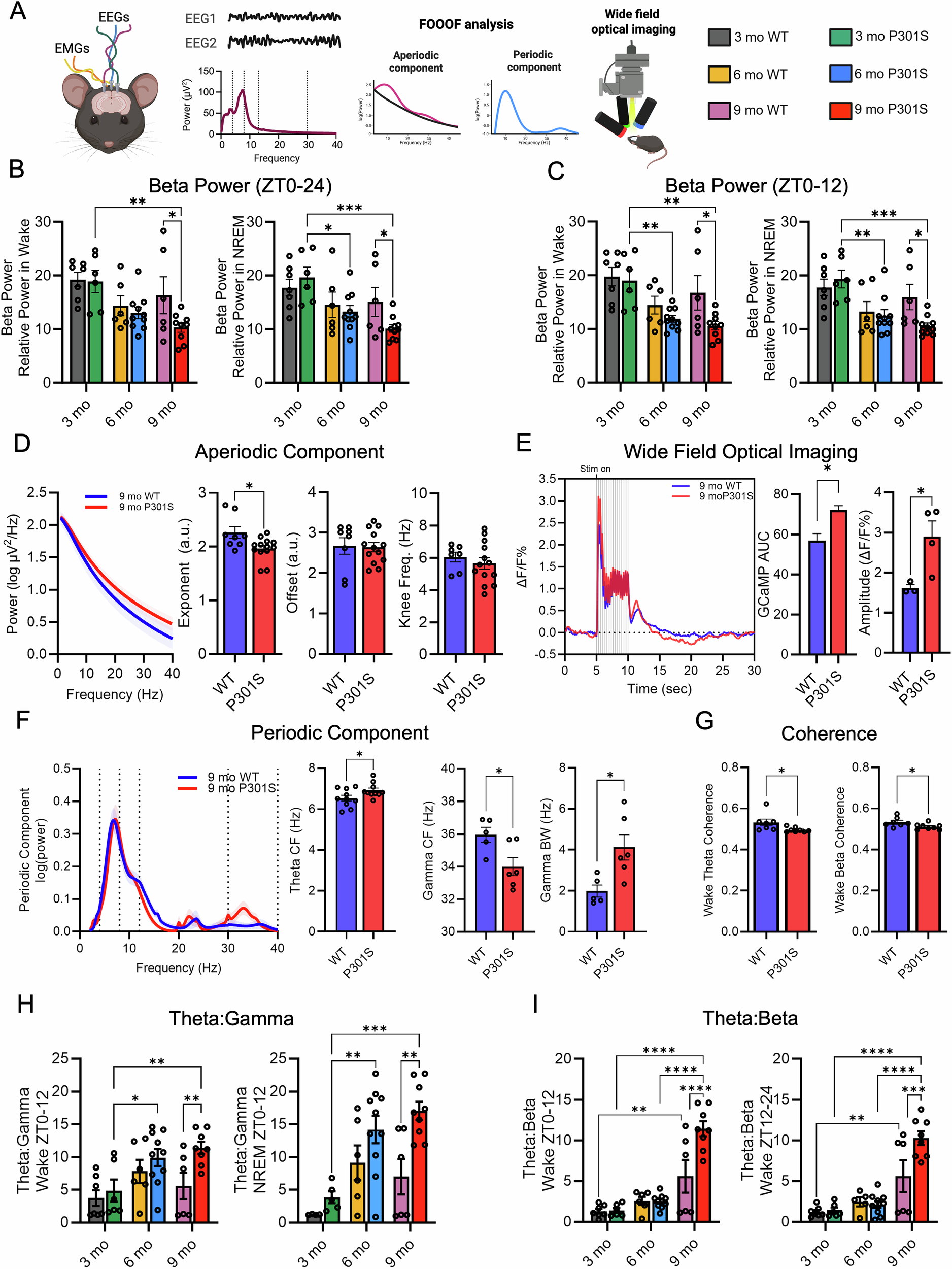Fig. 6: Tau pathology disrupts E/I balance by decreasing beta power and increasing excitability.