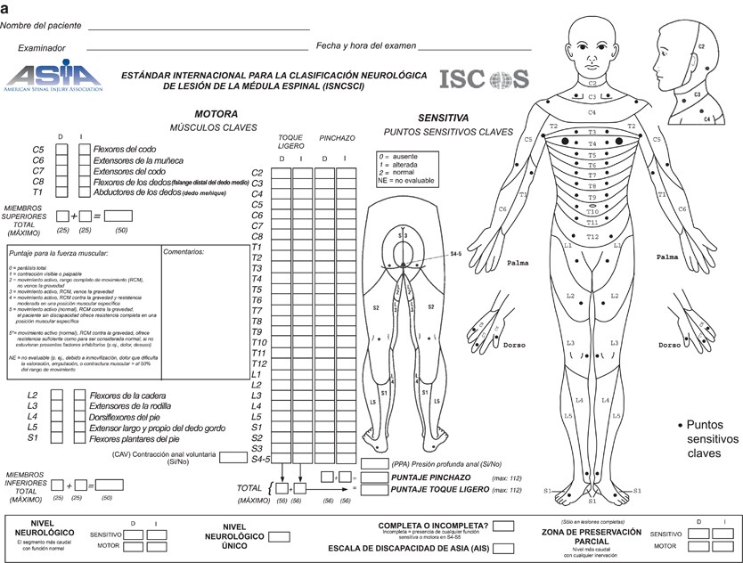 Spinal Cord Injury Chart