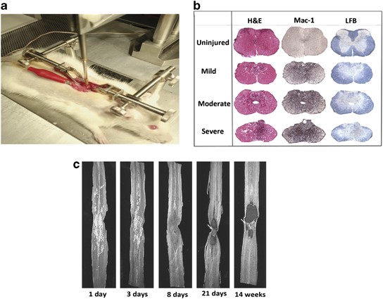 Spinal cord injury models: a review | Spinal Cord