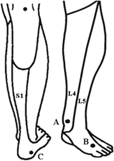 Sensory thresholds at different sites of the foot: a valuable reference for  neurologic examinations | Spinal Cord
