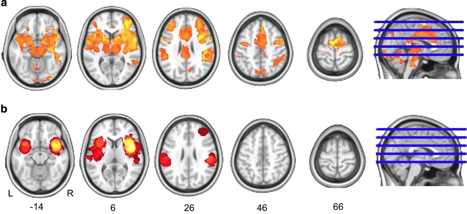 Figure 6: One-sample meta-analysis of 21 studies investigating the effect of pain.