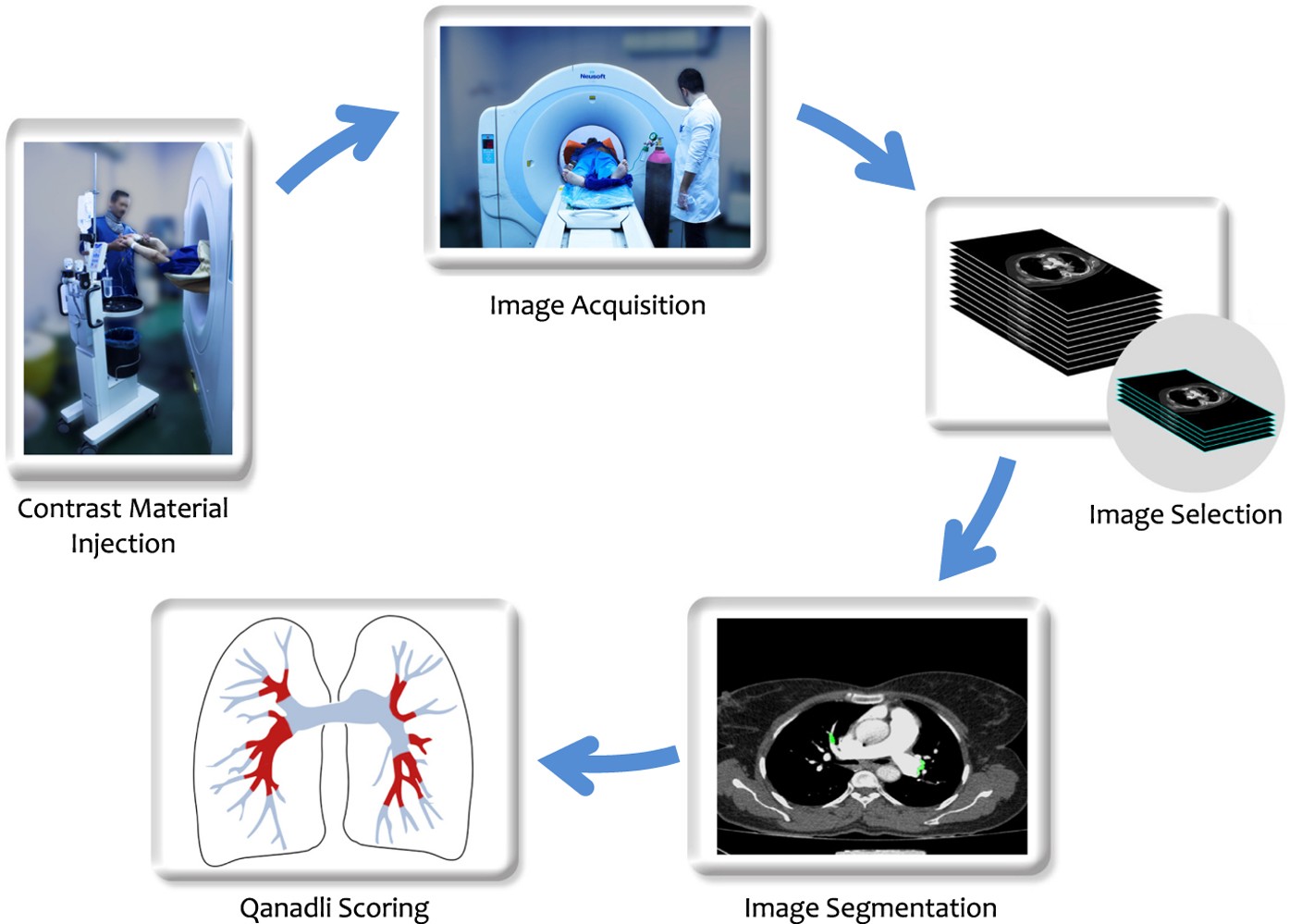 A new dataset of computed-tomography angiography images for computer-aided detection of pulmonary embolism | Scientific Data