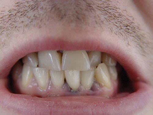 Lead poisoning | British Dental Journal