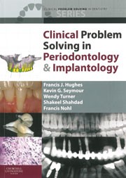 Clinical problem solving in periodontology and implantology | British Dental  Journal