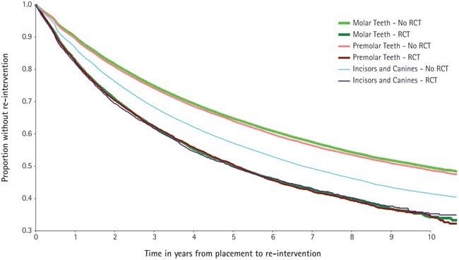 Influence of root canal fillings on longevity of direct and indirect  restorations placed within the General Dental Services in England and Wales  | British Dental Journal