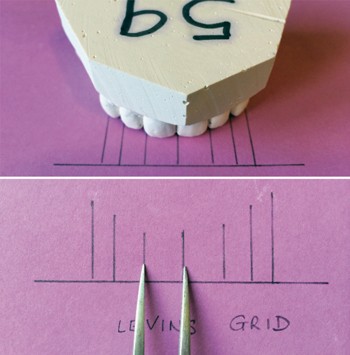 Upper Anterior Tooth Dimensions In A Young Adult Indian Population In The Uk Implications For Aesthetic Dentistry British Dental Journal