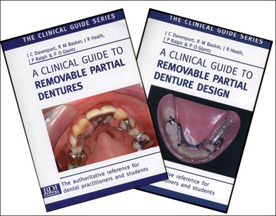 removable partial dentures an introduction british dental removable partial denture design