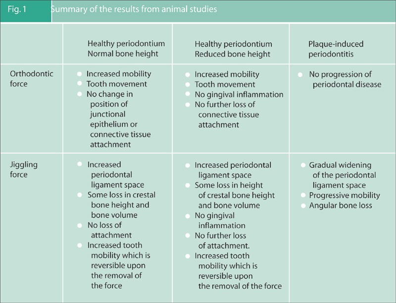 Occlusal Considerations In Periodontics British Dental Journal