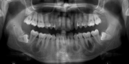 Print Quiz: CEMENTO (dental)