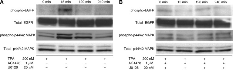 BCL6 degradation caused by the interaction with the C-terminus of  pro-HB-EGF induces cyclin D2 expression in gastric cancers | British  Journal of Cancer
