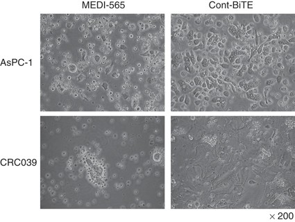 Metastatic Colorectal Cancer Cells From Patients Previously Treated With Chemotherapy Are Sensitive To T Cell Killing Mediated By Cea Cd3 Bispecific T Cell Engaging Bite Antibody British Journal Of Cancer