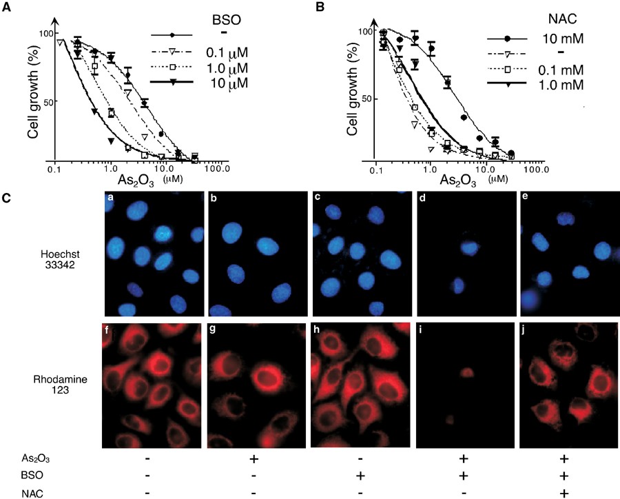 bso cancer treatment glutathione Effective treatment of advanced solid tumors by the combination of arsenic  trioxide and L-buthionine-sulfoximine