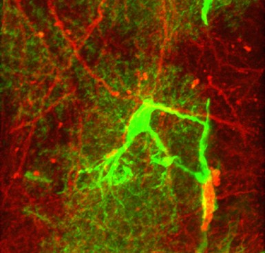 Glia The Fulcrum Of Brain Diseases Cell Death Differentiation Glia The Fulcrum Of Brain Diseases Cell Death Differentiation