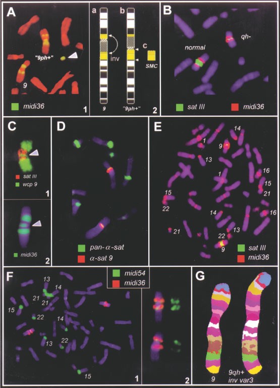 Homologous sequences at human chromosome 9 bands p12 and q13-21.1 are  involved in different patterns of pericentric rearrangements | European  Journal of Human Genetics