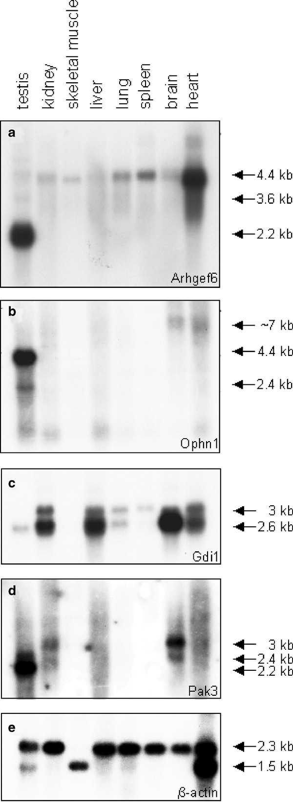 Large-scale neuroanatomical study uncovers 198 gene associations in mouse  brain morphogenesis