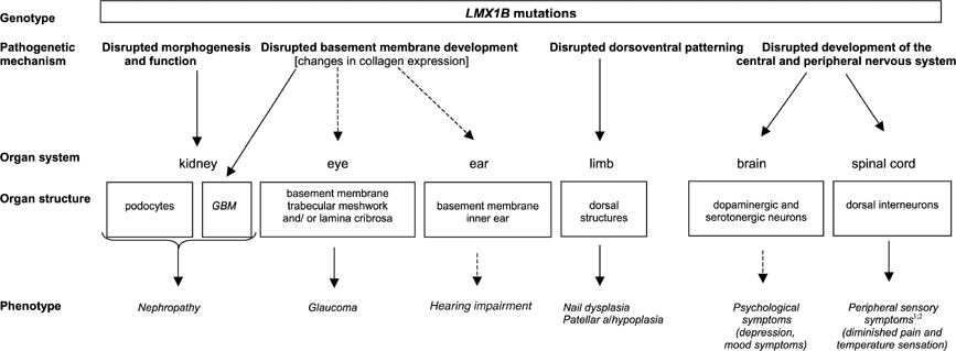 Genotype–phenotype studies in nail-patella syndrome show that LMX1B  mutation location is involved in the risk of developing nephropathy |  European Journal of Human Genetics