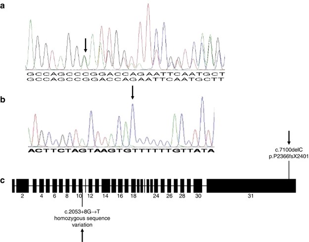 Genetic heterogeneity in Rubinstein–Taybi syndrome: delineation of the  phenotype of the first patients carrying mutations in EP300