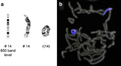 Roest Vader de elite Ring chromosome formation as a novel escape mechanism in patients with  inverted duplication and terminal deletion | European Journal of Human  Genetics
