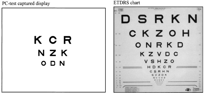 Etdrs Eye Chart