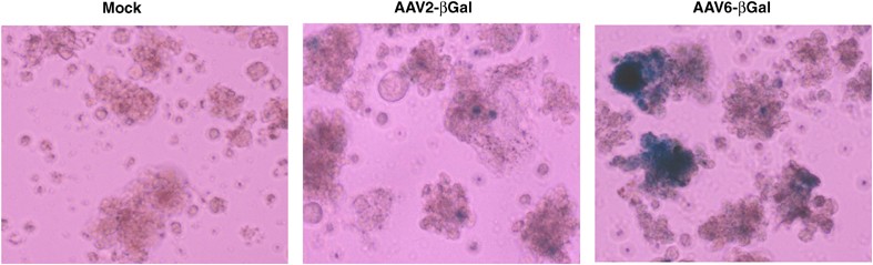 Enhanced transduction of mouse bone marrow derived dendritic cells