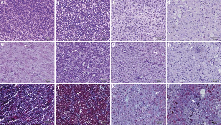 The effect of the histological properties of tumors on transfection  efficiency of electrically assisted gene delivery to solid tumors in mice |  Gene Therapy