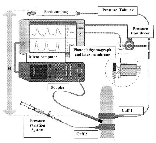 Validation of a continuous penile blood-flow measurement by  pulse-volume-plethysmography | International Journal of Impotence Research