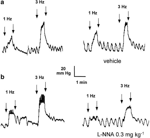 Vardenafil Reverses Erectile Dysfunction Induced By Paroxetine In