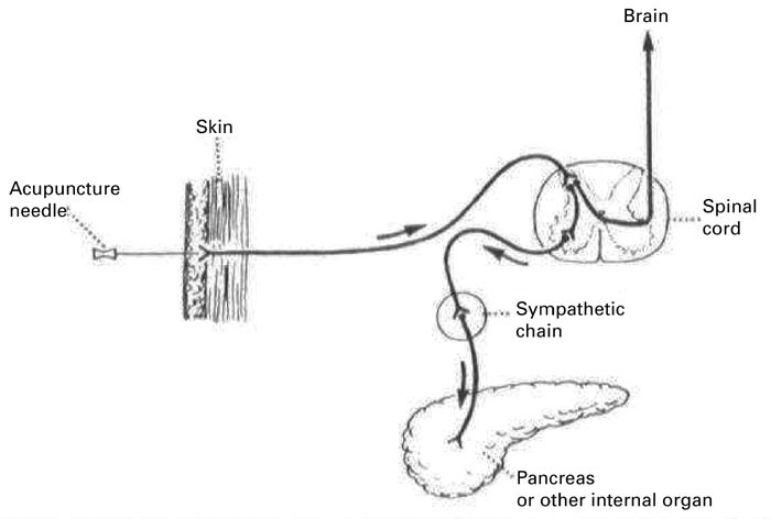 Acupuncture Placement Chart