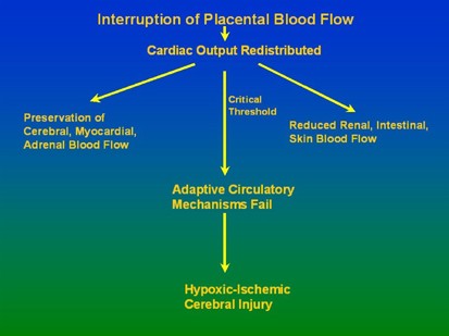 Pathogenesis Of Hypoxic Ischemic Brain Injury Journal Of