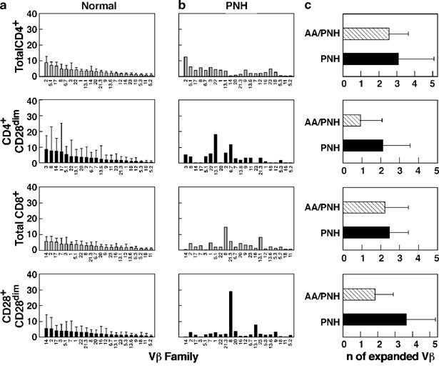 Large Granular Lymphocyte Lgl Like Clonal Expansions In Paroxysmal Nocturnal Hemoglobinuria Pnh Patients Leukemia
