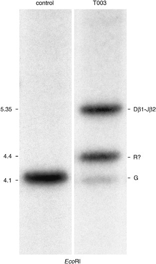 Bmi1 As Oncogenic Candidate In A Novel Tcrb Associated Chromosomal Aberration In A Patient With Tcrgd T Cell Acute Lymphoblastic Leukemia Leukemia