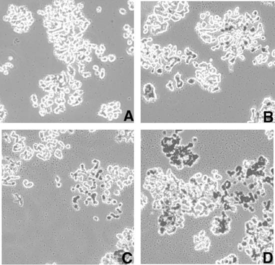 Nerve growth factor induces survival and differentiation through two  distinct signaling cascades in PC12 cells | Oncogene