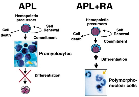 In vivo analysis of the molecular pathogenesis of acute promyelocytic  leukemia in the mouse and its therapeutic implications | Oncogene