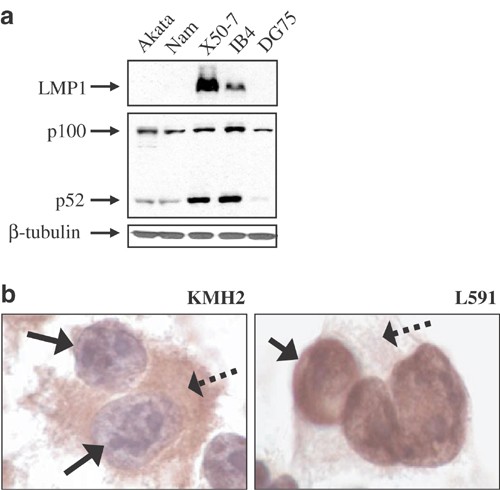 Epstein–Barr virus-encoded latent infection membrane protein 1 regulates  the processing of p100 NF-κB2 to p52 via an IKKγ/NEMO-independent  signalling pathway | Oncogene