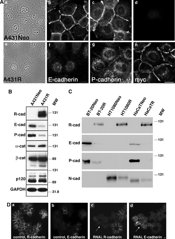 Expression Of Inappropriate Cadherins By Epithelial Tumor Cells Promotes Endocytosis And Degradation Of E Cadherin Via Competition For P1ctn Oncogene