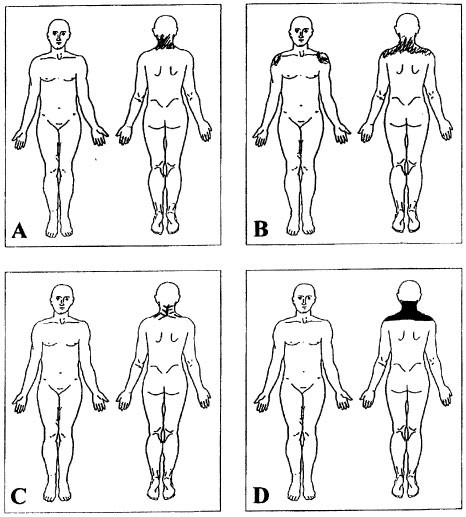 https://media.springernature.com/full/springer-static/image/art%3A10.1038%2Fsj.sc.3101259/MediaObjects/41393_2002_Article_BF3101259_Fig1_HTML.jpg