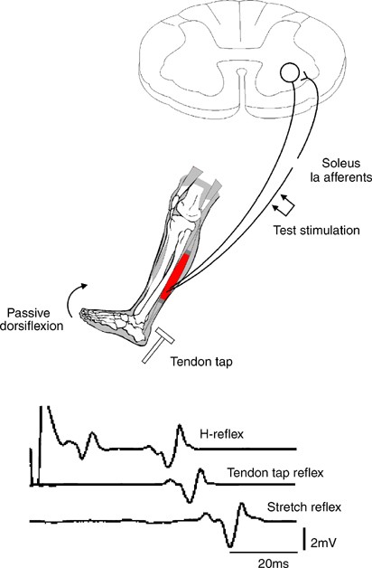 Electrical Muscle Stimulation Machines: A Comprehensive Guide, by kk  Sharma